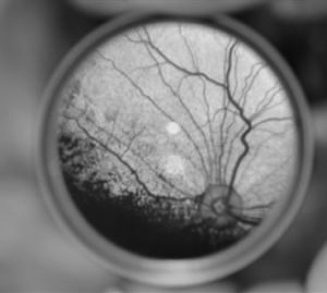 Progressive retinal atrophy in the Japanese Spitz dog: a clinical and genetic study